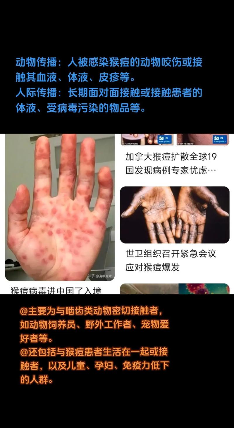 江苏南京疫情最新消息,江苏南京疫情最新通告?-第7张图片-柯迪百科 江苏南京疫情最新消息,江苏南京疫情最新通告?-第7张图片-柯迪百科