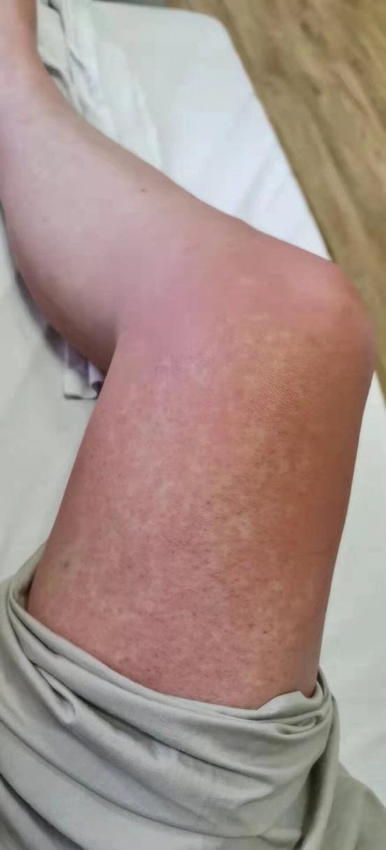 新加坡当前疫情,新加坡疫情又多起来了-第2张图片-柯迪百科 新加坡当前疫情,新加坡疫情又多起来了-第2张图片-柯迪百科