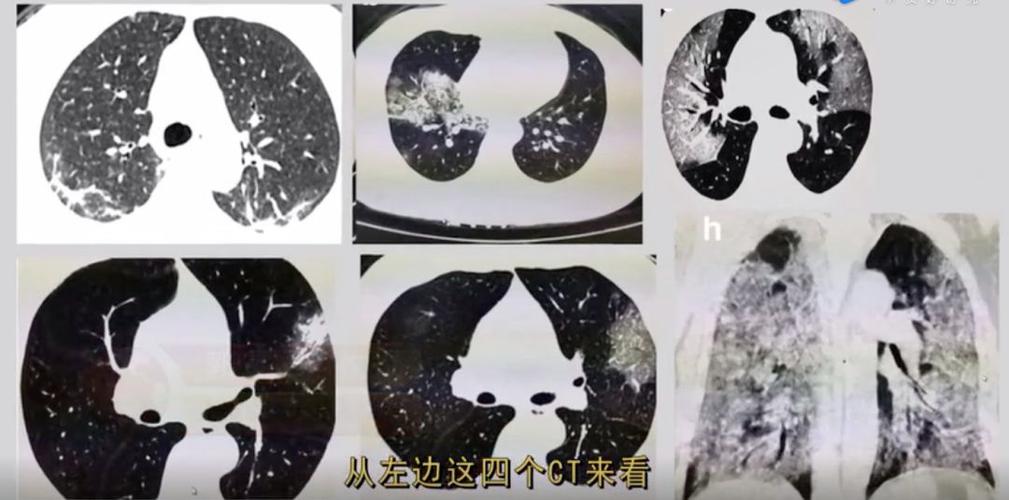 疫情前与疫情中的对比?疫情前与疫情后?-第6张图片-柯迪百科 疫情前与疫情中的对比?疫情前与疫情后?-第6张图片-柯迪百科