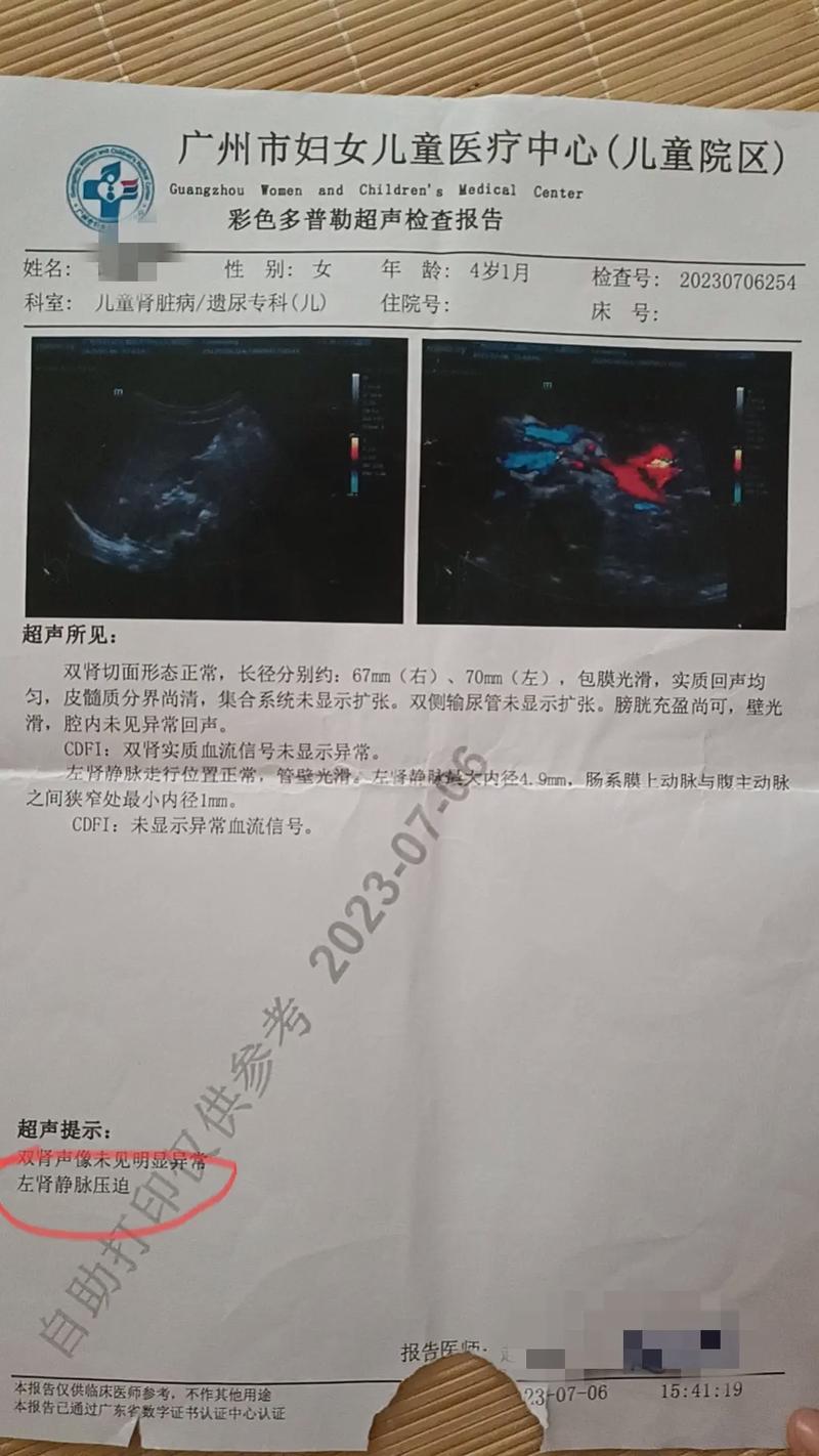 广州疫情有疫情吗,广州疫情有哪些地区-第2张图片-柯迪百科 广州疫情有疫情吗,广州疫情有哪些地区-第2张图片-柯迪百科