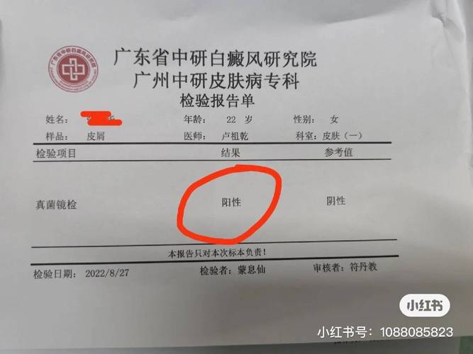 广州疫情有疫情吗,广州疫情有哪些地区-第4张图片-柯迪百科 广州疫情有疫情吗,广州疫情有哪些地区-第4张图片-柯迪百科