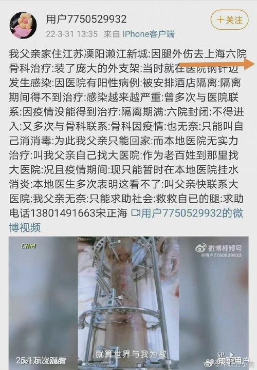疫情期间市民关注疫情,疫情期间百姓关心的问问题-第8张图片-柯迪百科 疫情期间市民关注疫情,疫情期间百姓关心的问问题-第8张图片-柯迪百科