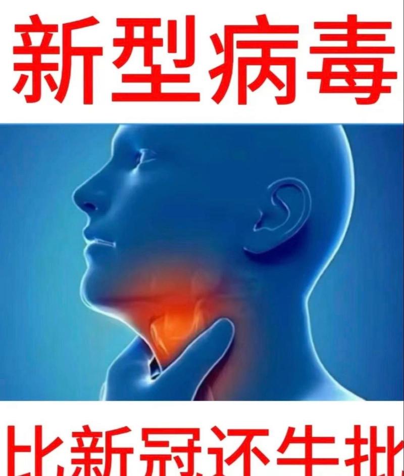 感染疫情都有什么症状,感染疫情的症状表现-第6张图片-柯迪百科 感染疫情都有什么症状,感染疫情的症状表现-第6张图片-柯迪百科