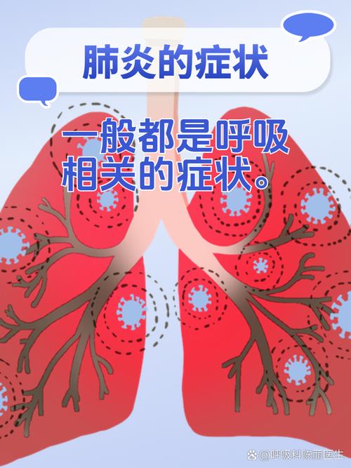 疫情症状表现有哪些?疫情症状症?-第6张图片-柯迪百科 疫情症状表现有哪些?疫情症状症?-第6张图片-柯迪百科